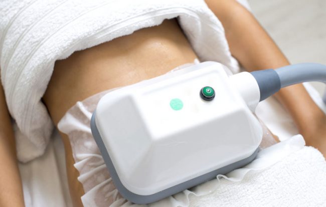 noleggio-criolipolisi-minus-lipo-6